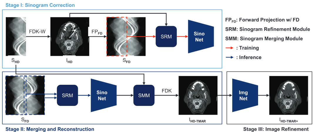A multi-stage deep learning framework for half-detector truncation and metal artifact reduction in CBCT